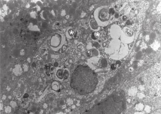 Resim 4c: Aynı gruba ait bez epitel hücresi. * : Stoplazmada çok sayıdaki apoptotik cisimcikler. Resim 4a: 12 haftalık grubun yüzey epiteline ait elektron mikroskop resmi.