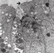 >> : Yan yüz bağlantıları, M: Mitokondriyon, * : Poliribozomlar, : GER tubulusları, BM: Bazal membran, küçük resim: aktif stromal hücre.