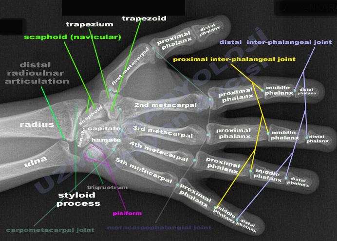 Articulatio Radioulnaris Distalis: Radius ve ulna nın alt uçları arasında meydana gelen bir eklemdir.