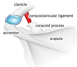 Articulatio Acromioclaviculare: Scapula nın acromion isimli çıkıntısı ile clavicula nın üzerindeki facie articularis acromialis arasında