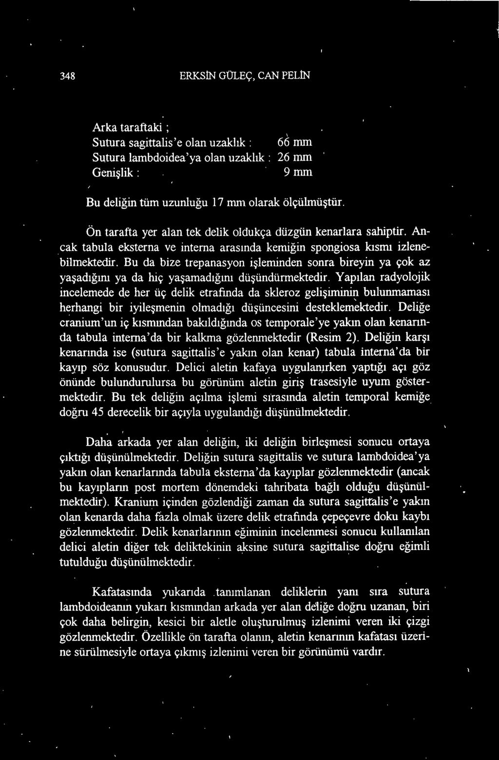 Deliğe cranium'un iç kısmından bakıldığında os temporale'ye yakın olan kenarında tabula intema'da bir kalkına gözlenmektedir (Resim 2).