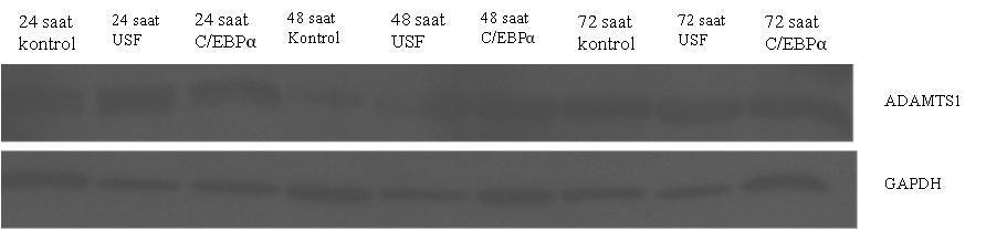 Densitometrik Oran 0,97 0,96 0,95 0,94 0,93 0,92 0,91 0,9 24h kontrol 24h usf 24h cebp 48h kontrol 48h usf 48h cebp 72h kontrol 72h usf 72h cebp ġekil 3.