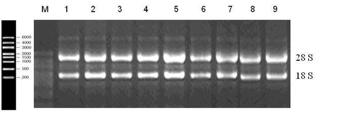 Hücre kültürü ortamında bölüm 2.2.4 de anlatıldığı şekilde büyütülen hücre soylarından total RNA izolasyonları yapılarak ve cdna eldesi yapıldı. Total RNA izolasyonu ve cdna sentezi bölüm 2.2.5 de belirtildiği şekilde yapıldı.