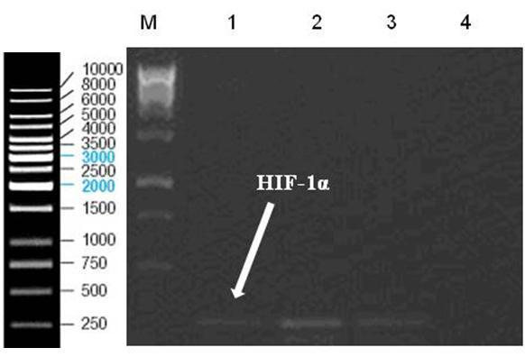 3.2.1.1 Hep3B hücrelerinde kimyasal indüklenmiģ hipoksik koģulun doğrulanması Çalışmamızda Hep3B hücre hattında CoCl 2 uygulaması ile hipoksik koşul oluşturuldu.