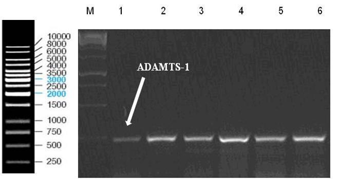 hücrelerde, CoCl 2 ile indüklenen hipoksiya durumunda, ADAMTS-1 mrna ve protein ekspresyon seviyesi hızlı bir şekilde arttığı tespit edilmiştir.