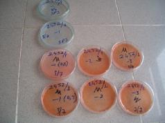 Resim 1. 14: Petri kutusunun yazılması Numunenin bulunduğu tüp ya da kaptan 1 ml lik gibi düşük hacimli bir pipetle 0.1 ml örnek alınır.