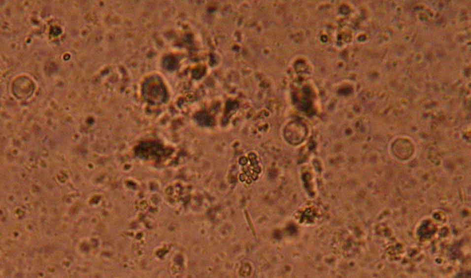 4.BULGULAR Bu çalışmaya dahil edilen Blastocystis suşları Eylül 2011 Kasım 2012 tarihleri arasında Gazi Üniversitesi Tıp Fakültesi Hastanesi Mikrobiyoloji Araştırma Laboratuvarı ve Ankara Numune
