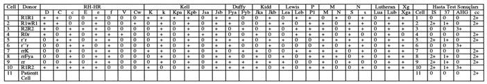 9 3. 2, 5, 8, 9 ve 10 no hücrelerde, IS, 37 C ve AHG fazlar nda farkl fliddette reaksiyon görülmesi birden fazla say da antikorun varl n iflaret edebilir. 4.