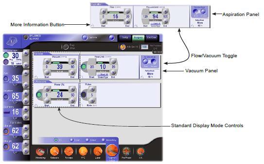 Constellation Vision System Aspirasyon Paneli More Information düğmesi Akış/Vakum Değişimi Vakum Paneli Standart Görünüm Modu Kontrolleri Şekil 2-83 Surgery (Ameliyat) Ekranı: Fragmentation