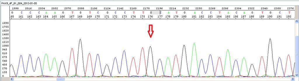 %2 lik agaroz jel elektroforezi sonrası, etidyum bromür ile boyanmış ve UV görüntüleme sistemi yardımıyla görüntülenmiştir.