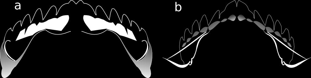 Şekil 3. 50: a. Chaetocladius tip-grubuna ait mentum ve ventromental plak yapısı, b. Psectrocladius tip-grubuna ait mentum ve ventromental plak yapısı. (Çizim: G.K. AKYILDIZ) 3.2.4.