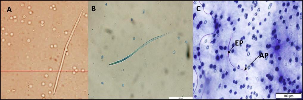 köpekte ise kanda mikrofiler görülmezken PCR analizlerinde D. immitis pozitif belirlenmiştir. Konvansiyonel perifer kan muayenesinde diğer filarial nematodlara ait mikrofilerlere rastlanmamıştır.