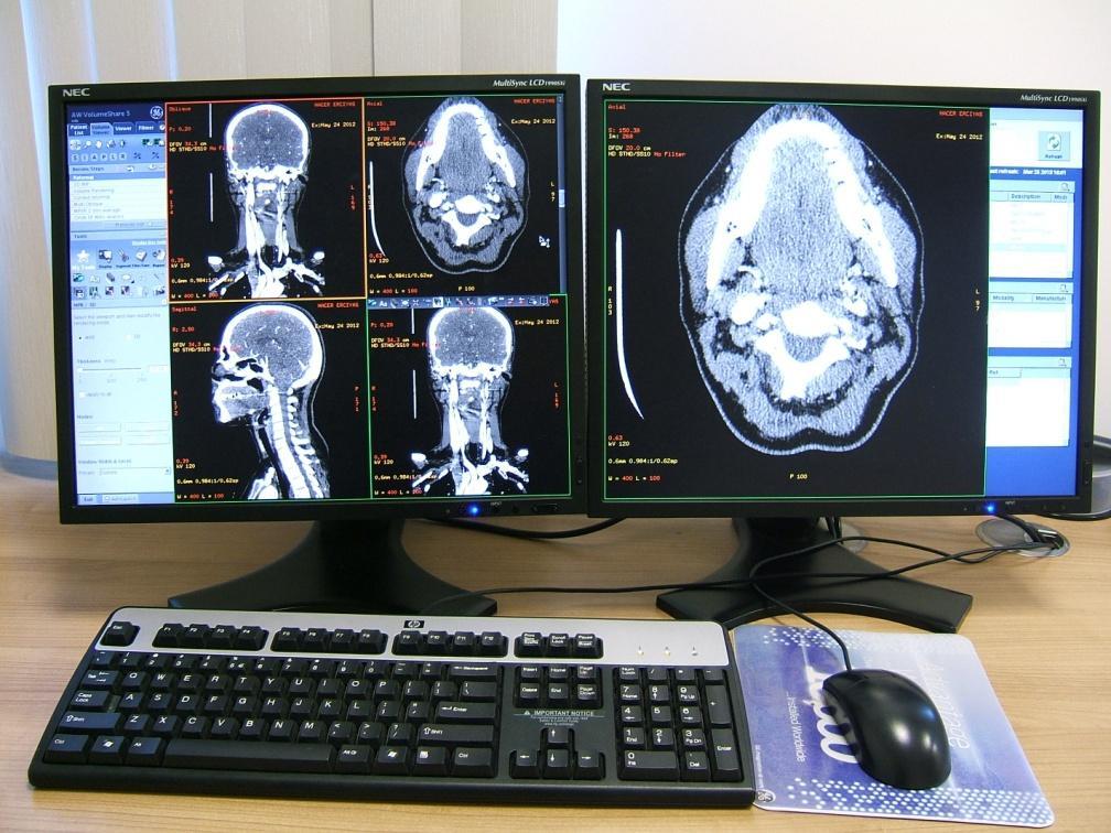 Resim 8: ĠĢ istasyonu 3.4.1.Anatomik değerlendirme: Servikal vertebral kolon aksını etkileyen eğriliklerin (skolyoz ve kifoz) varlığı, sagittal ve koronal reformat görüntülerden belirlendi.