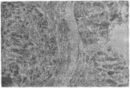 gün gliserol grubunda perifer bölgede rejenerasyon belirtileri izlenmektedir (H.E., x400). 30. Gün : Periferde küçük çapta miyelinli sinir lifleri izlenmiştir.