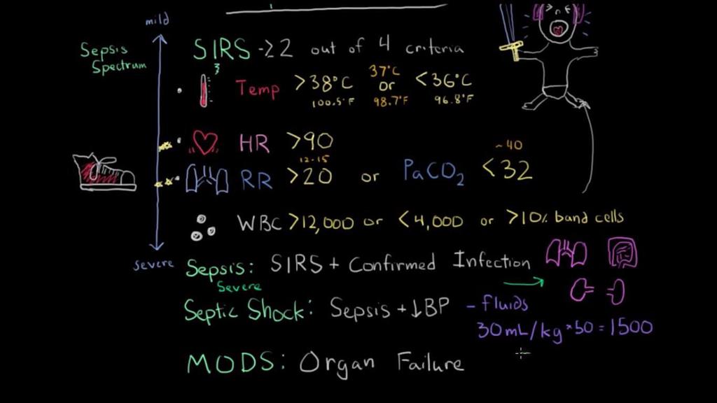 Sepsis