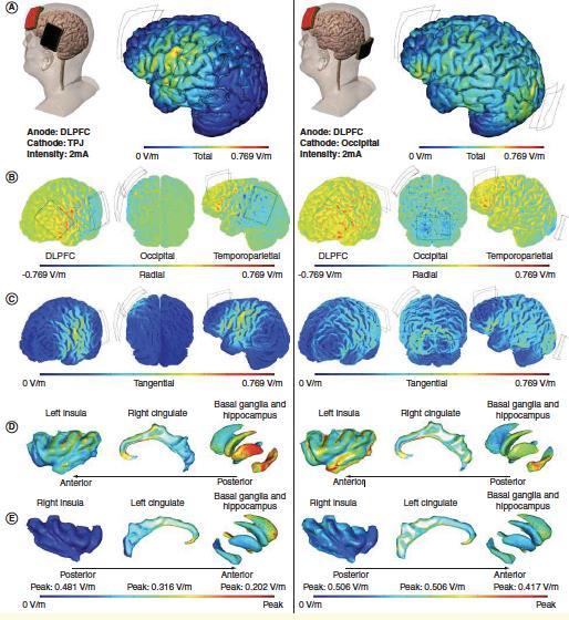 Transcranial