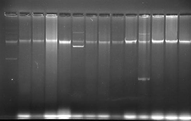 1 2 3 4 5 6 7 8 9 10 11 12 13 14 Kromozomal DNA Şekil 4.