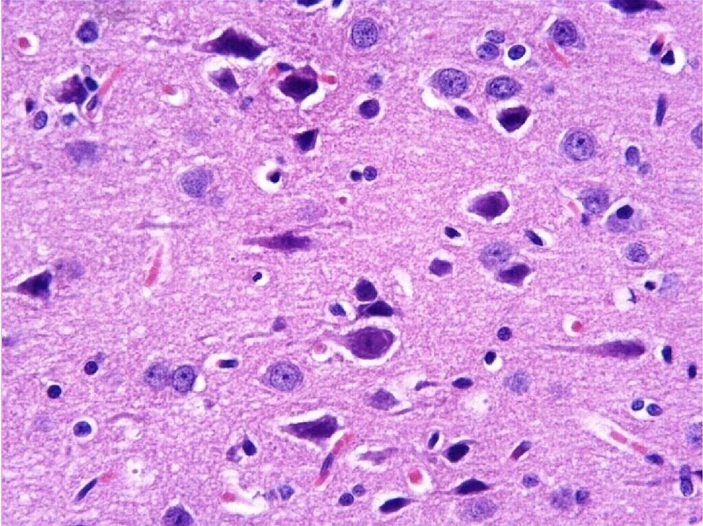 Resim 8. M grubu. Dejenere nöronların görünümü (oklar). H-E; X40. Resim 9. M grubu. Mavi-mor renkte boyanmış nöronlar (oklar).