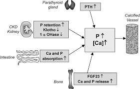 Artmış serum kalsiyum, fosfat ve PTH düzeyi, vasküler