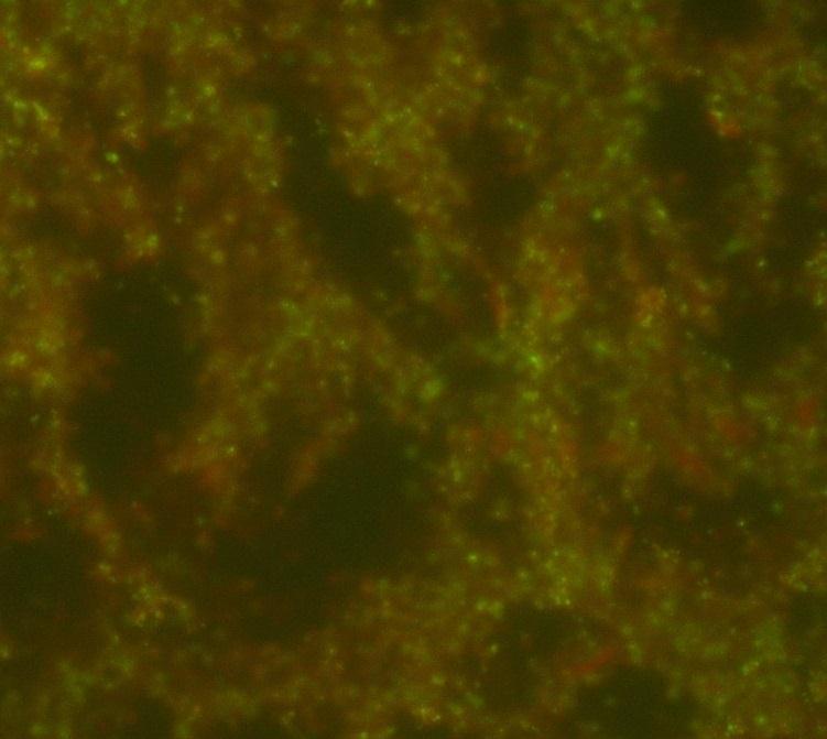 pozitif reaksiyonun fluoresan mikroskop altındaki görünümü (40X).