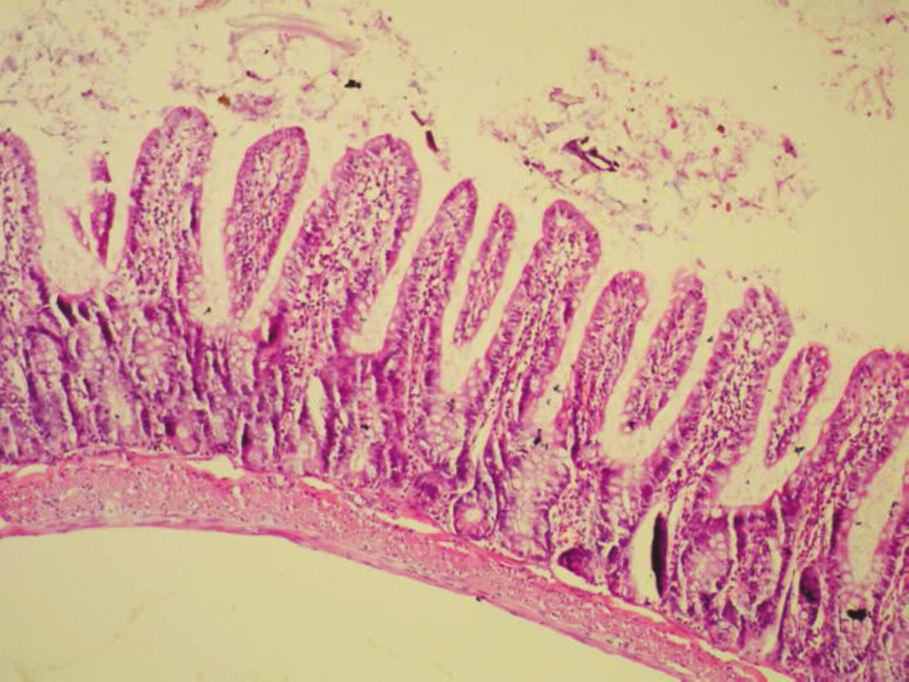 9,10 Pinacidil in etkisini değerlendiren bir çalışmada bu ajanın sarkoplazmik K-ATP kanalı gösterilen hücrelerde Ca+2 yüklenmesini önleyip hücreyi hasardan koruduğu görülmüştür.