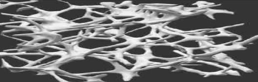 Trabeküla Bağlantılarında Kayıp: Osteoporotik trabeküler kemikte, trabeküler ağ bozulmuş ve özellikle yatay trabekülalarda kayıp söz konusudur (18). 3.