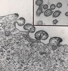 Şekil 3: Respiratuar sinsityal virüsün elektron mikroskobik fotoğrafı Respiratuar sinsityal virüs genomu 10 viral protein kodlar.