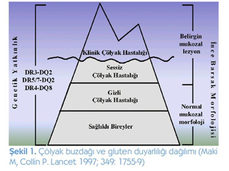 Diyarbakır da yapılan çalışmalarda spastik kolon prevalansının %6,2 ile 19,1 arasında değiştiği bildirilmiştir.