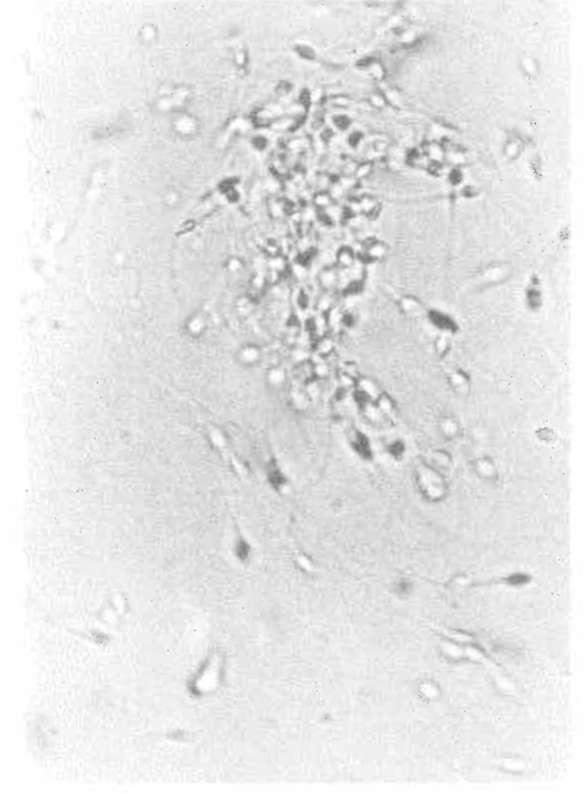 E J E K U L A T MUAYENESİ 87 mal normal değer mililitre başına 40 000 000 ya da tüm ejekulatta 125 milyon sperm olarak kabul edilebilir.