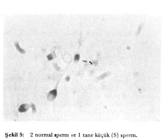 88 ALİ RIZA AYDER - SEDAT ÜNAL Ejekulat çıkarıldıktan 2 3 saat sonra gözlendiğinde spermlerin en az %60'uıın iyi bir ileri hareketle beraber güçlü motiliteye sahip olmaları gerekmektedir.