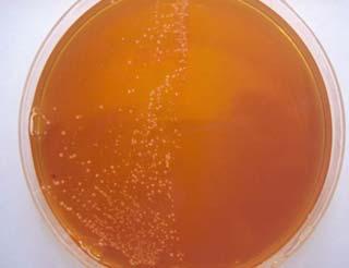 Resim-3.2. MRS agar besiyerinde üreyen Lactobacillus izolatları Çalışmamızda, Down Sendromlu 7 çocuğa ait tükürük örneğinde, TYCSB agar besiyerinde, S.mutans izole edilmedi.