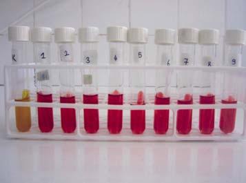 K K (a) (b) Resim-3.3. (a) S.mutans ın, mannitol, sorbitol, melibiyoz, rafinoz ve inülin fermentasyonu sonucu oluşan görüntü (b) S.