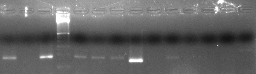 65 yapılmıştır. Çalışma sonunda; K-562 kronik myeloid lösemi hücrelerinin Bid geninin promotor bölgesinde EZH2 ve DNMT1 proteinlerinin bağlı olduğu ayrıca bu bölgedeki H3 histon proteinlerinin 27.