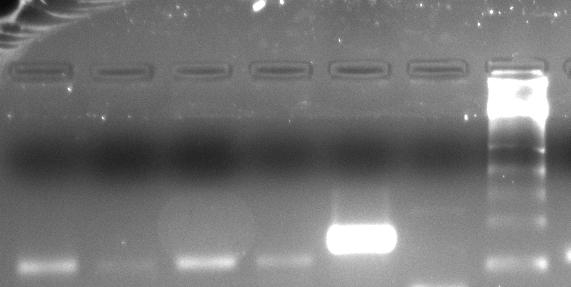 66 geninin promotor bölgesinde EZH2 ve DNMT1 proteinlerinin bağlı olduğu belirlenmiştir.