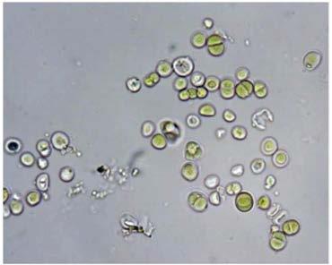18 Resim 2.2. Chroococcus sp. türüne ait bir görünüm [61] Phormidium sp.