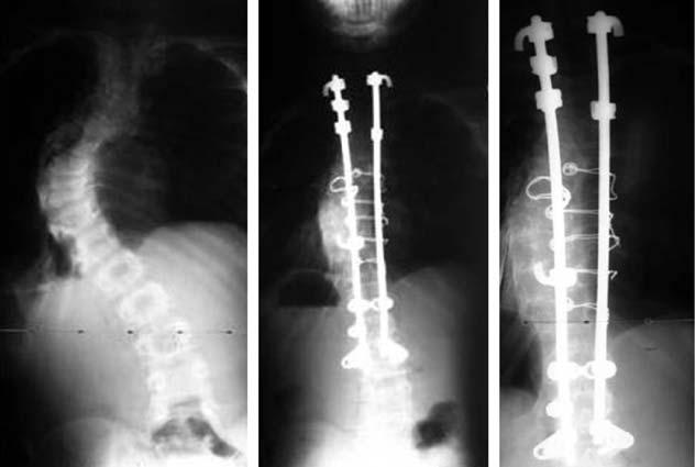 278 Acta Orthop Traumatol Turc (a) (b) (c) fiekil 1.