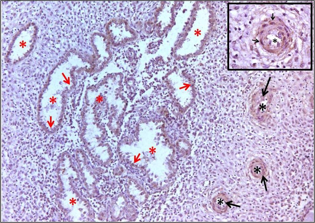 84 Damar endotel hücrelerindeki immünoreaktifliğin yanı sıra arteriyollerin çevresindeki kas hücrelerinde de immünoreaktif olduğu görüldü.