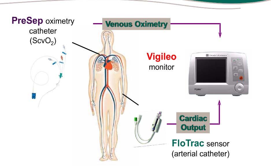 Vigileo