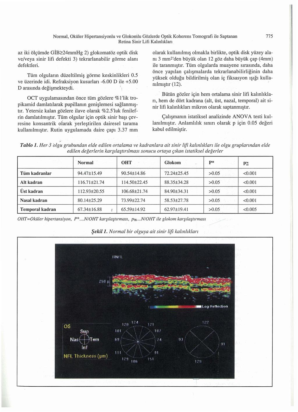 Normal, Okiiler Hipertansiyonlu ve Glokorrilu Gozlerde Optik Koherens Tomografi ile Saptanan Retina Sinir Lifi Kalmhklan 775 az iki Ol~iimde GiB?