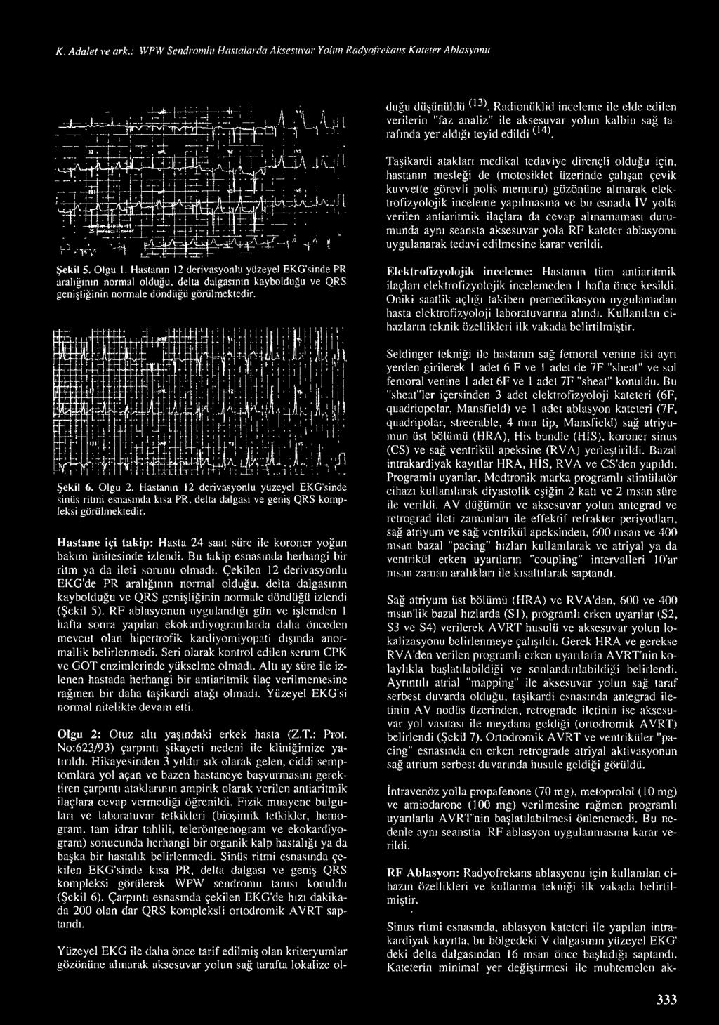 düşünü l dü (l3). Radionüklid inceleme ile elde edilen verilerin "faz analiz" ile aksesuvar yolun kalbin sağ tarafında yer a ldığ ı teyid edildi 0 4 ).