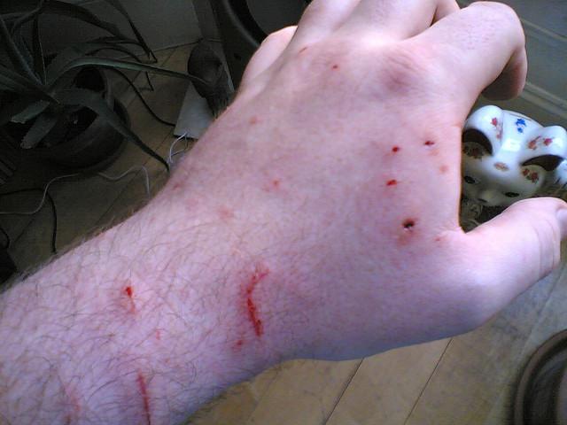 Bir kedi tarafından ısırıldınız Beden Acı Ağrı Algı Kedinin görüntüsü