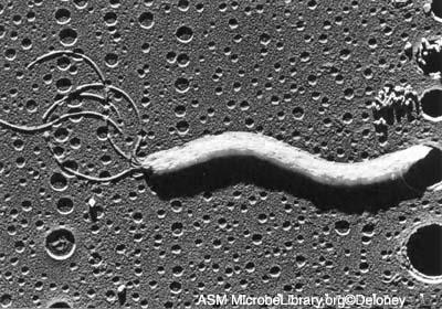 Helicobacter pylori Kılıflı, polar, demet halinde 4 flagellası var. Üreaz ve katalazı var. Aksial flamanı yoktur.