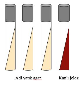 X ve V faktörüne gereksinimin araştırılması 1.