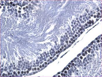 gösteren spermatogoniumlar (yeģil oklar) ve spermatosit