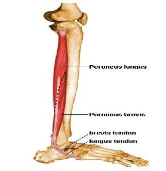 ekstansor digitorum longus) (26) Lateral Kompartman Peroneus longus ve peroneus brevis kasları bu kompartmanda bulunmaktadır.