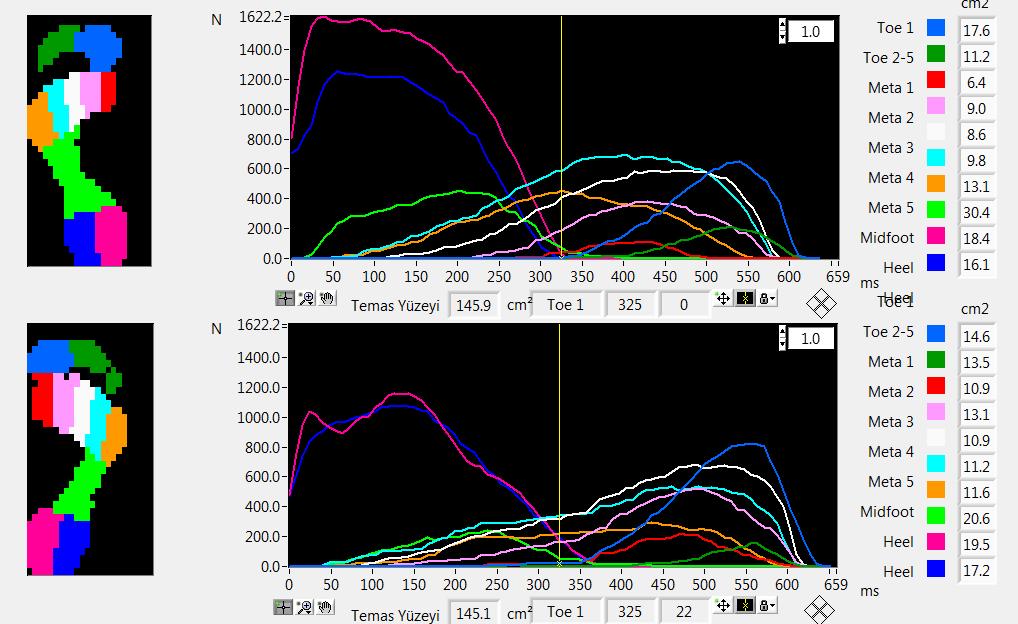 20 Ayağın statik pedobarografik değerlendirmesinde, ön ve arka ayaktaki maksimal basınç değerleri, ayaktaki toplam basınç, toplam basıncın ayağın ön/arka bölümüne düşen yüzdeleri, toplam temas alanı