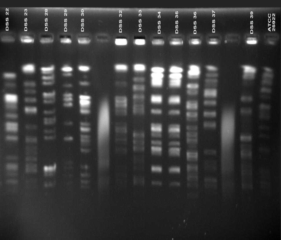 bant profilleri (Referans suş: E. coli ATCC 25922) Şekil 4.12.