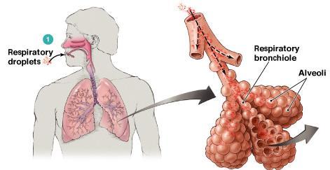 Alveollerde dört farklı olay gerçekleşebilir Damlacık çekirdeği ile