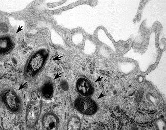 Alveollerde dört farklı olay gerçekleşebilir 1- Basiller güçlü bir konakçı yanıtı ile herhangi bir lezyon oluşturmadan, alveoller