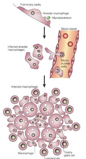 Alveollerde dört farklı olay gerçekleşebilir 2- Basil başlangıçta çoğalabilir ancak immun yanıtla birkaç milimetre çapında küçük kazaöz lezyonlar oluşur ve koruyucu immünite